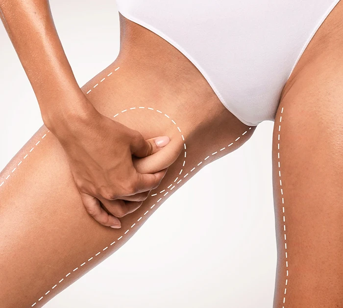 Ove procedure često se kombinuju sa liposukcijom radi postizanja optimalnih rezultata.